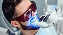 بیشتر بدانیم؛ بلیچینگ دندان یا سفید کردن دندان چیست ؟
