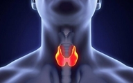 بمناسبت هفته اطلاع‌رسانی کم‌کاری تیروئید، بیشتر بدانیم؛ زنگ هشداری برای توجه به سلامت غده‌ای حیاتی